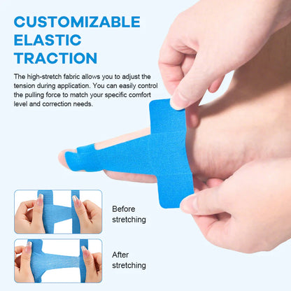 Comfort Royal | Bunion Corrector Tape