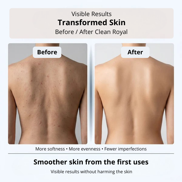 Clean Royal | Exfoliating Scrub Towel