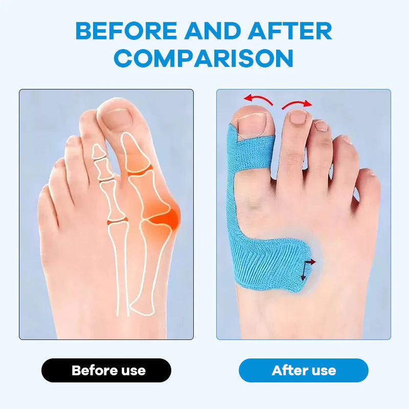 Comfort Royal | Bunion Corrector Tape
